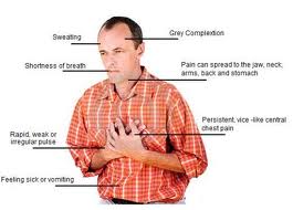 Heart Attack | Heart Attack Symptoms | Heart Attack Signs